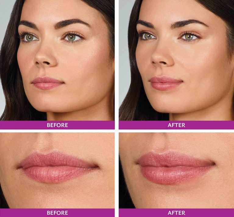 A collage of a person's lips

AI-generated content may be incorrect.